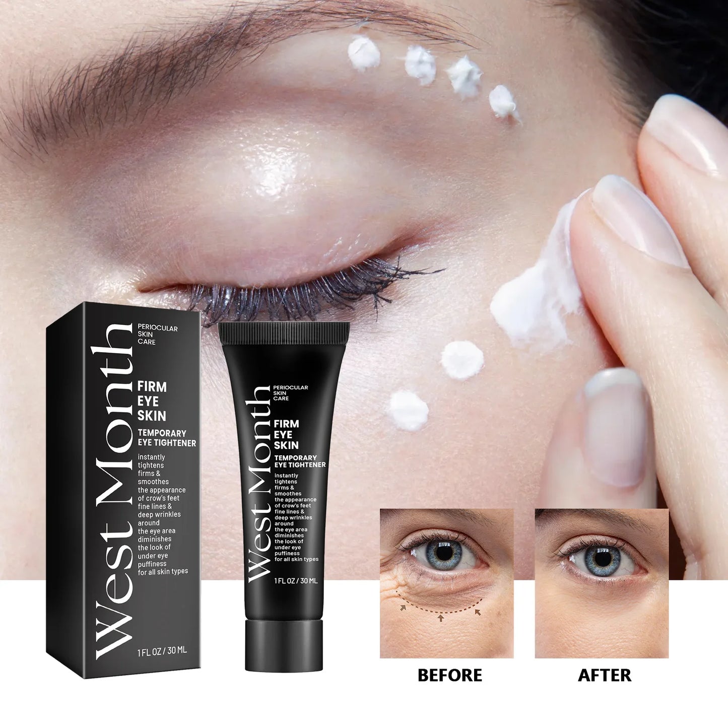 Retinol Eye Bag Removal Cream - Anti-Wrinkle, Dark Circle & Puffiness Eye Care Solution